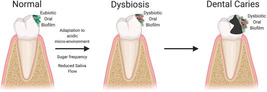 pesakit covid-19 boleh alami gejala lebih teruk jika malas berus gigi