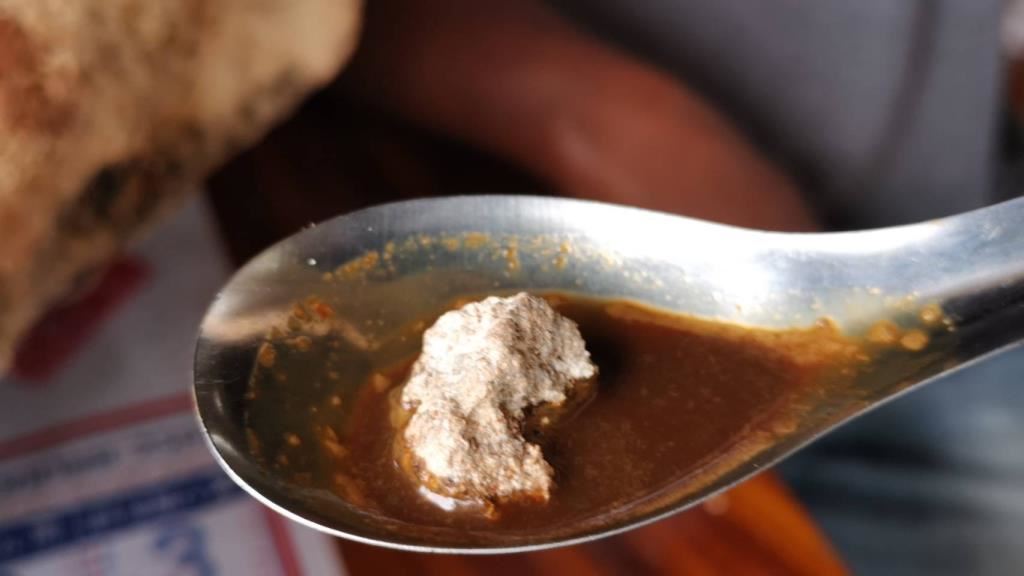 nelayan bakal jutawan lepas mahu jual 30kg muntah ikan paus