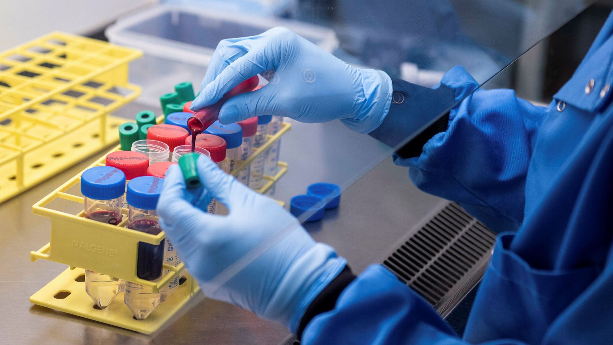 woman diagnosed with covid-19 for 335 days, dubbed the world’s longest infection