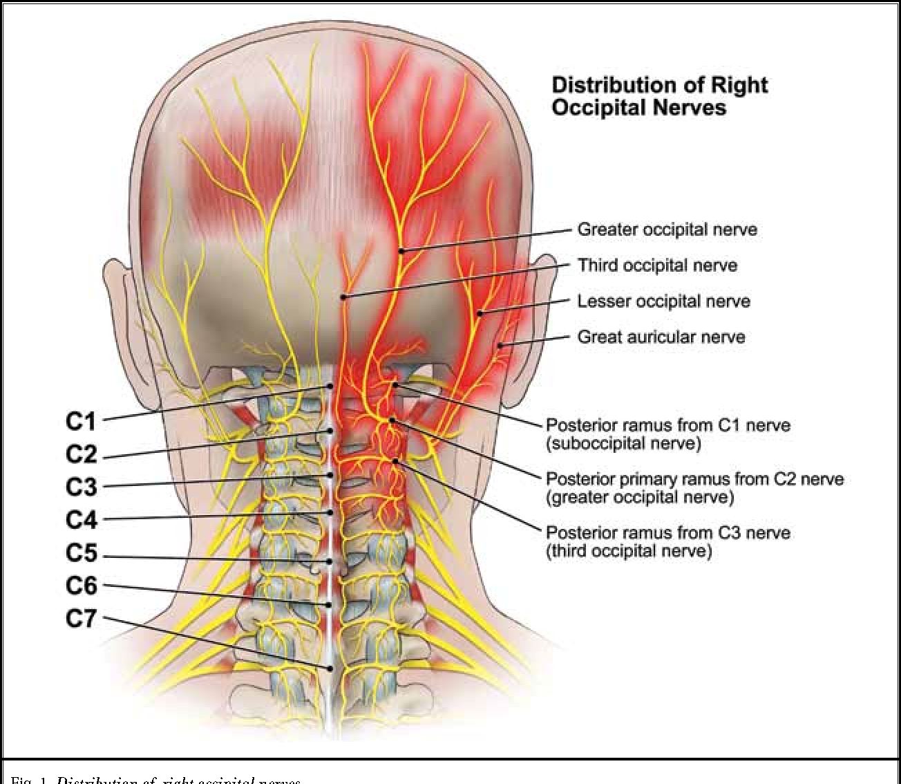 ini antara kemungkinan punca rasa sakit kepala sebelah kiri