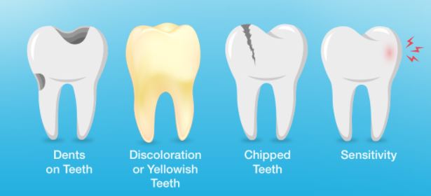 pakar beri amaran bahaya tabiat berus gigi lepas makan