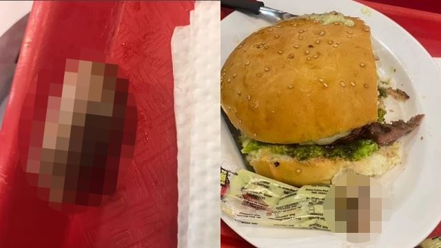  pelanggan terkejut jumpa jari manusia dalam burger, restoran makanan segera diarah tutup