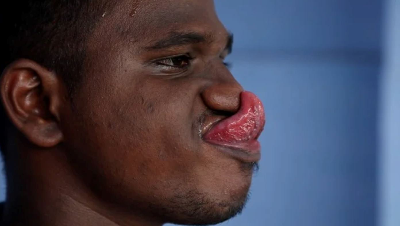 student in india has 10.8 centimeter long tongue, probably the world’s longest!