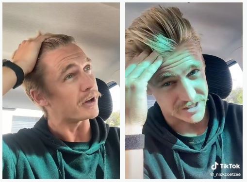 lelaki botak kini berambut semula lepas henti guna syampu