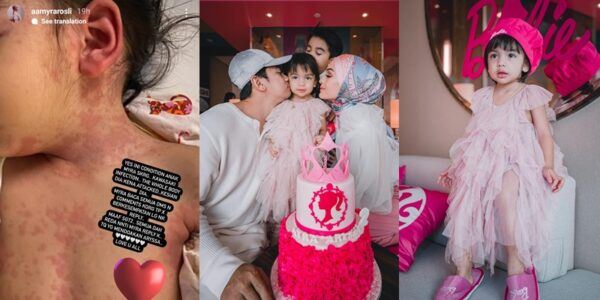 75 peratus pesakit adalah kanak-kanak, kenali apa itu penyakit kawasaki