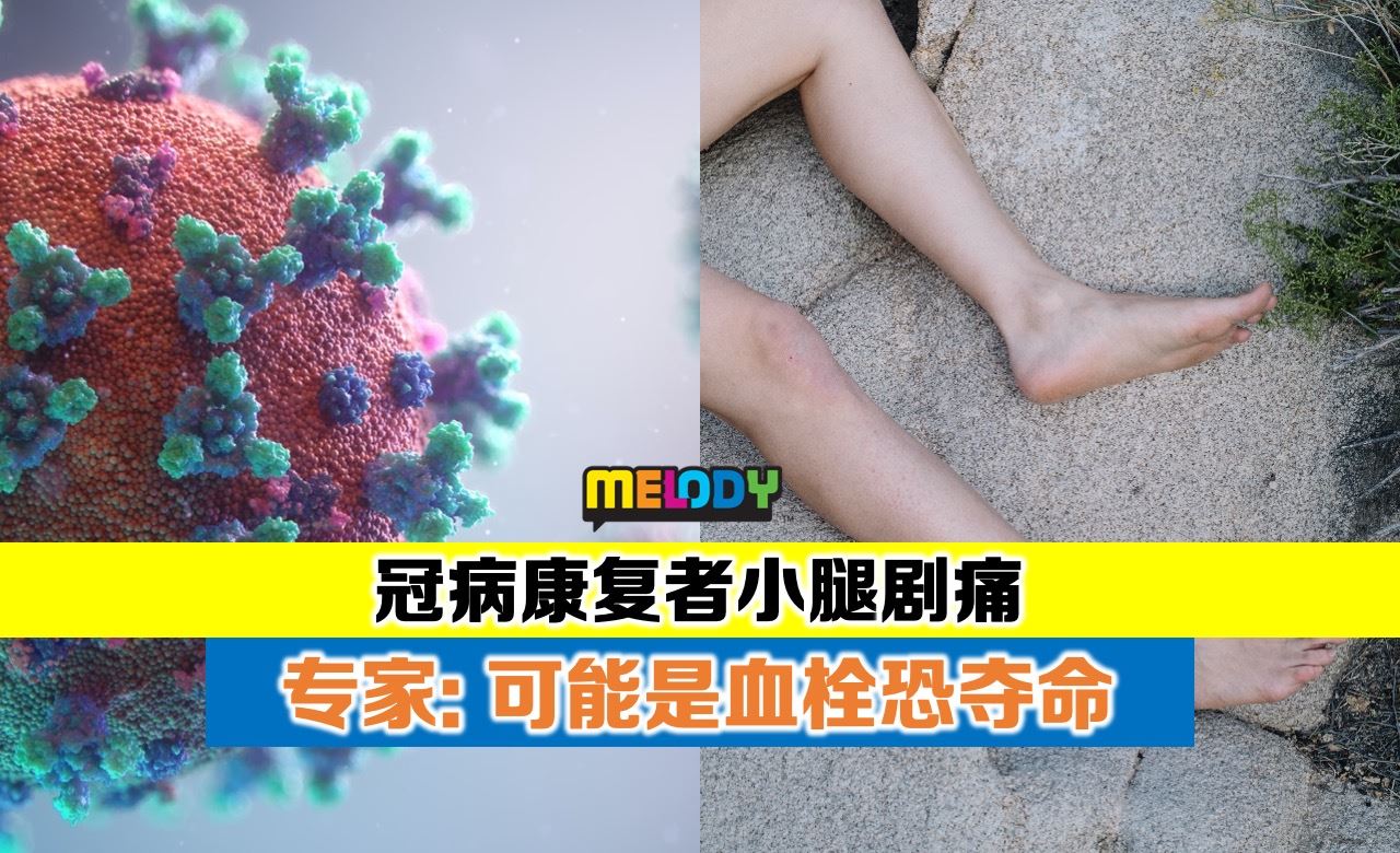 冠病康复者小腿剧痛 专家：可能是血栓恐夺命 | Melody