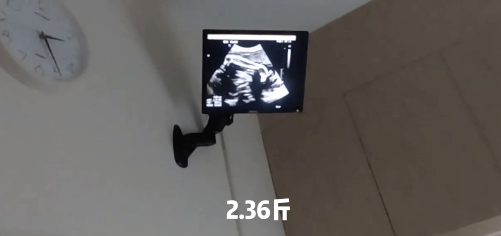 【娱乐】郑恺老婆无预警官宣怀二胎，挺孕肚自驾去产检！郑恺直呼：想回家！ 