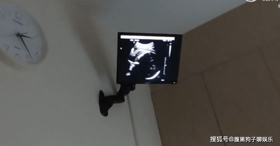 ❤️恭喜郑恺又要当爸爸了❗️苗苗晒产检影片官宣怀二胎👶