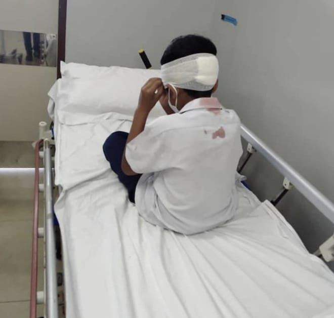 bapa bertindak pukul kanak-kanak tahun tiga sehingga cedera akibat anaknya ditampar rakan sekelas