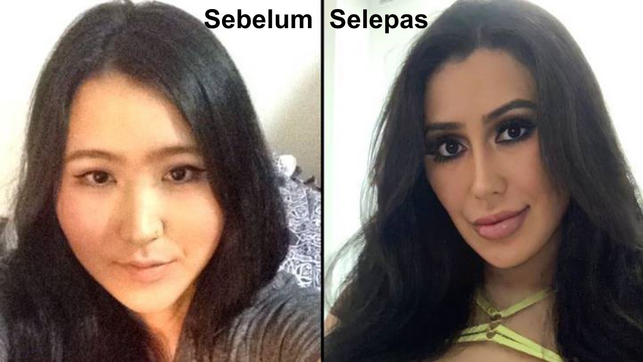 sanggup berhabis wang demi nak jadi kim kardashian, lihat hasilnya