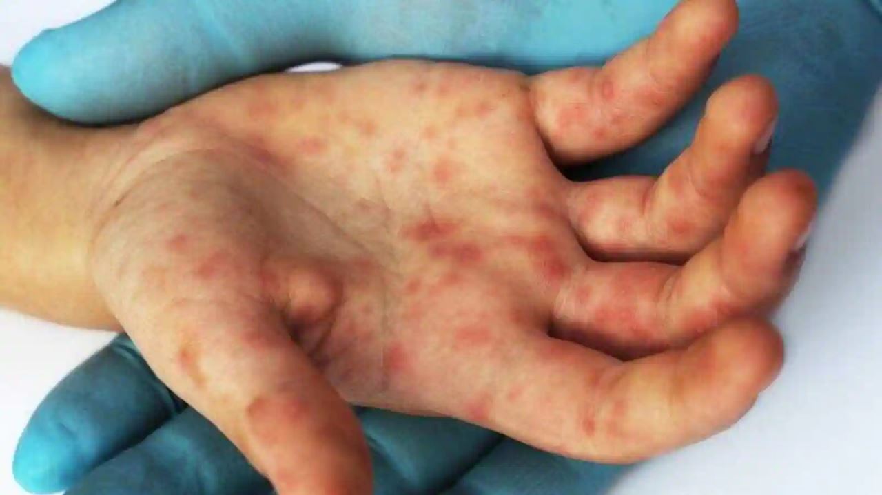 virus selesema tomato kini merebak di beberapa negeri dekat india