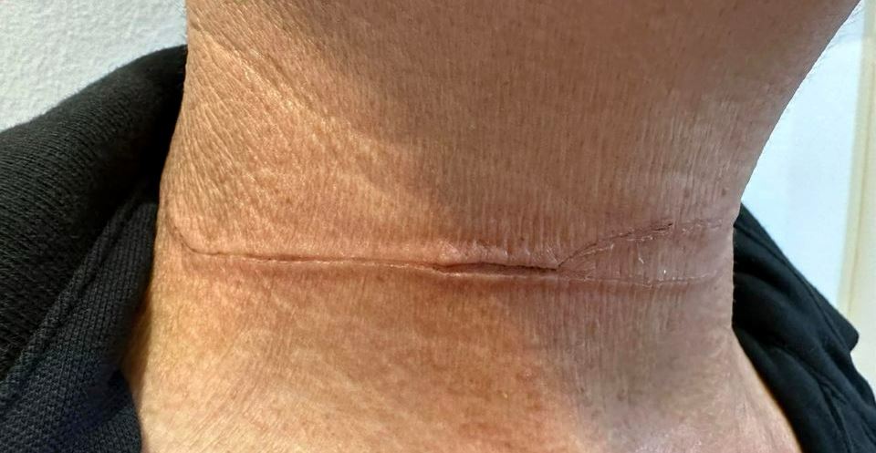 dangerous! man almost cuts his neck after getting caught on kite string while riding on his motorcycle in johor