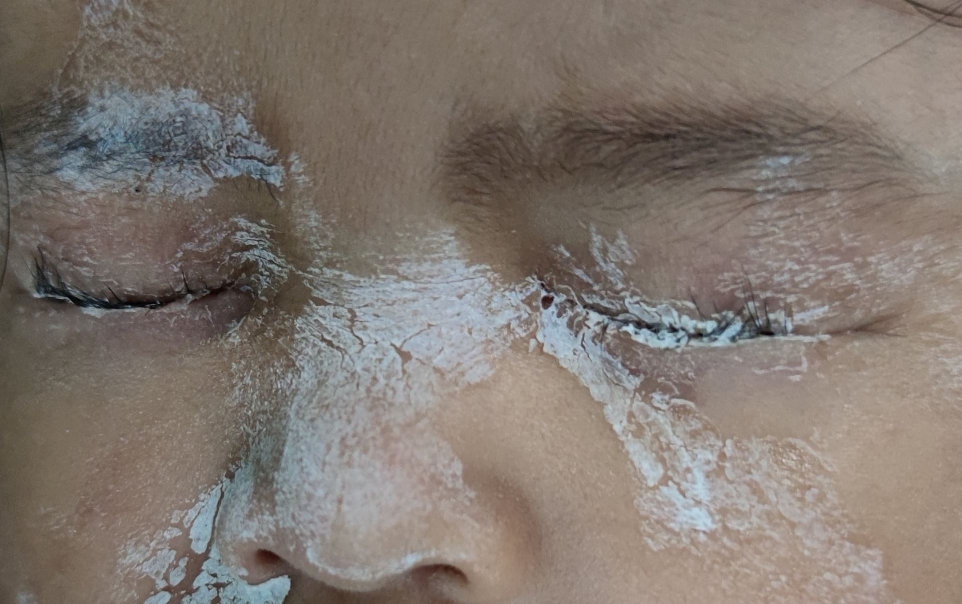 ‘kelopak mata melekat atas dan bawah,’ ibu tertumpah gam 3 saat pada wajah anak