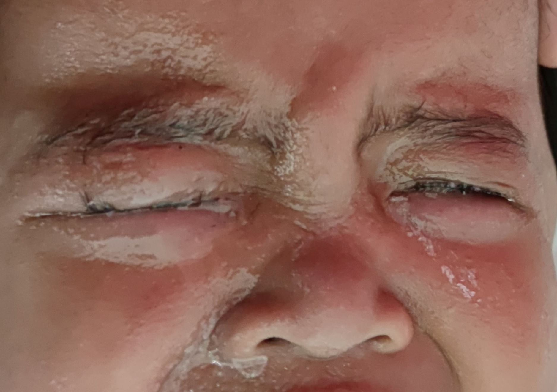 ‘kelopak mata melekat atas dan bawah,’ ibu tertumpah gam 3 saat pada wajah anak