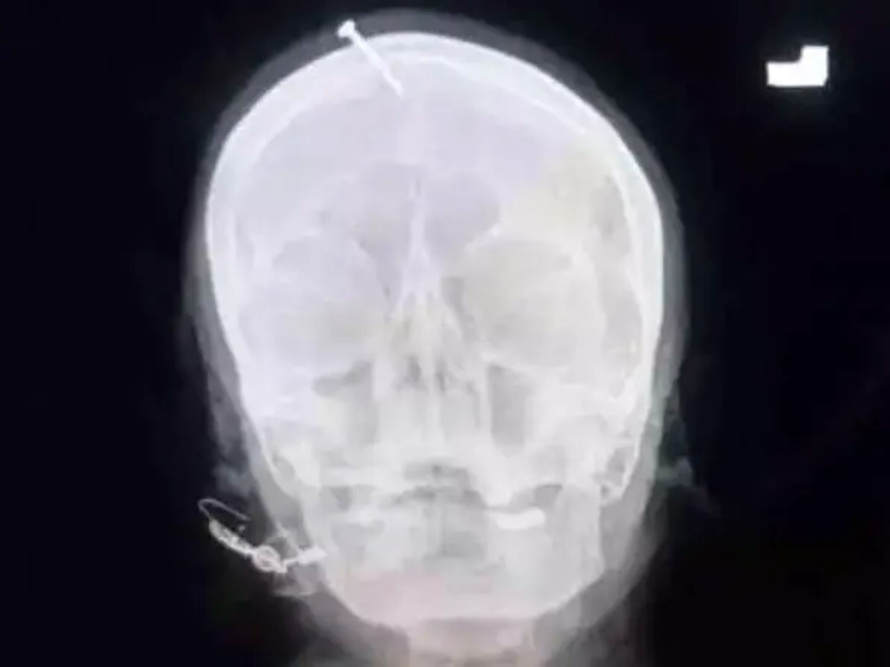 bomoh paku kepala wanita konon jamin dapat anak lelaki