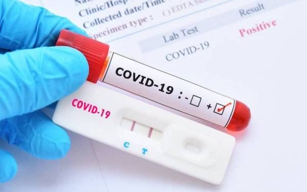 gambar keputusan ujian covid-19 perlu upload di mysejahtera.