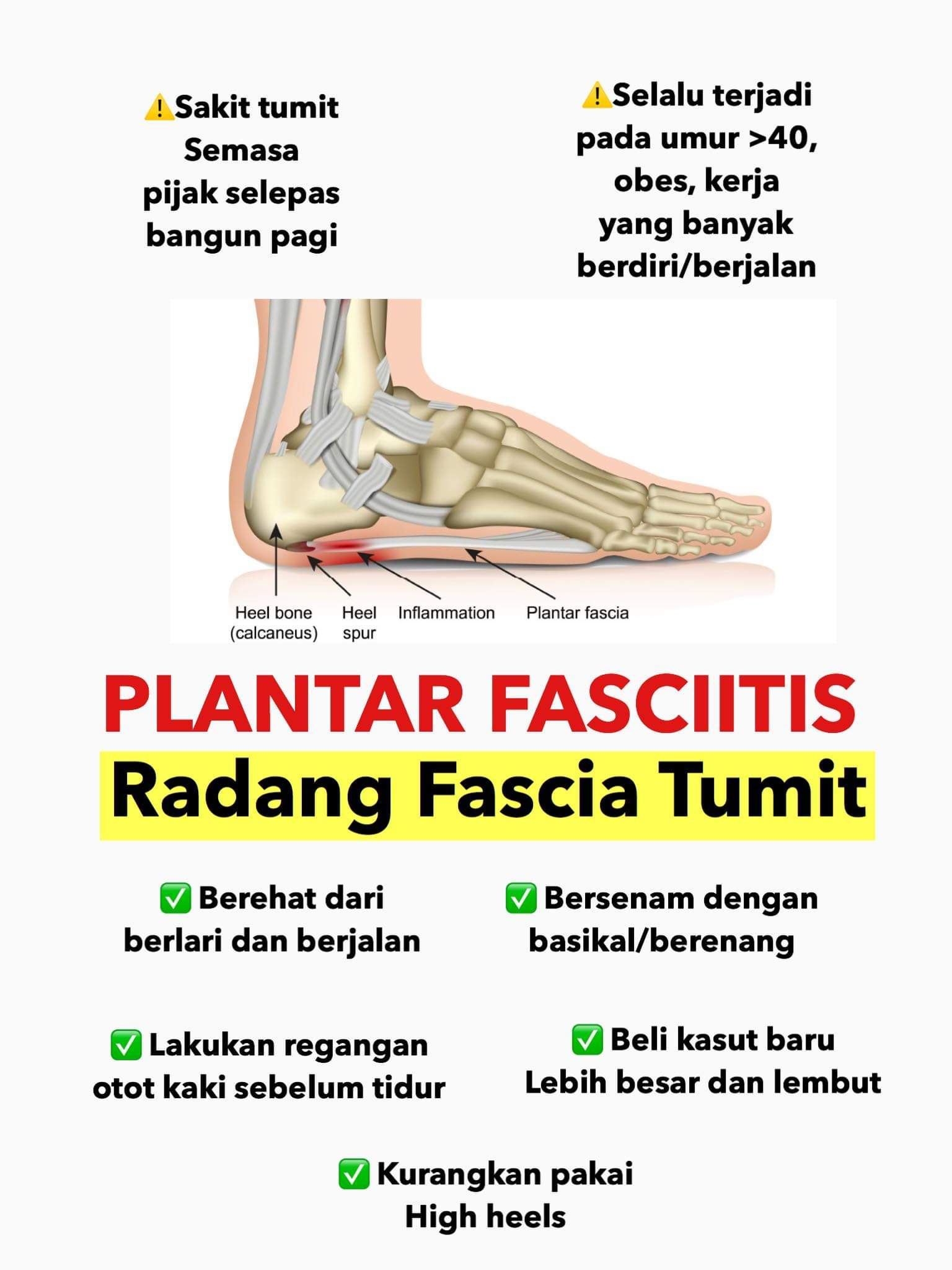sakit tapak kaki lepas bangun tidur? anda mungkin ada masalah ini