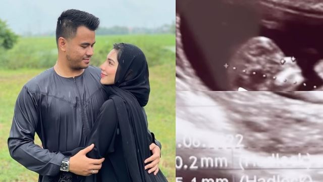 elisya sandha, suami bakal timang cahaya mata? peminat dapat ‘tangkap’ gambar imbasan ultrabunyi - “saya ternampak sesuatu, tahniah”