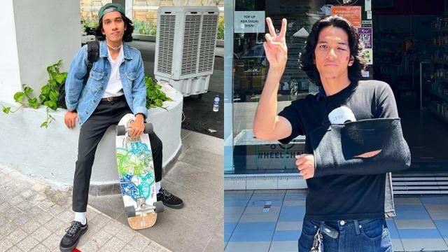 naim daniel cedera di tangan kiri akibat terjatuh main skateboard - “tangan okey tak patah, cuma..”
