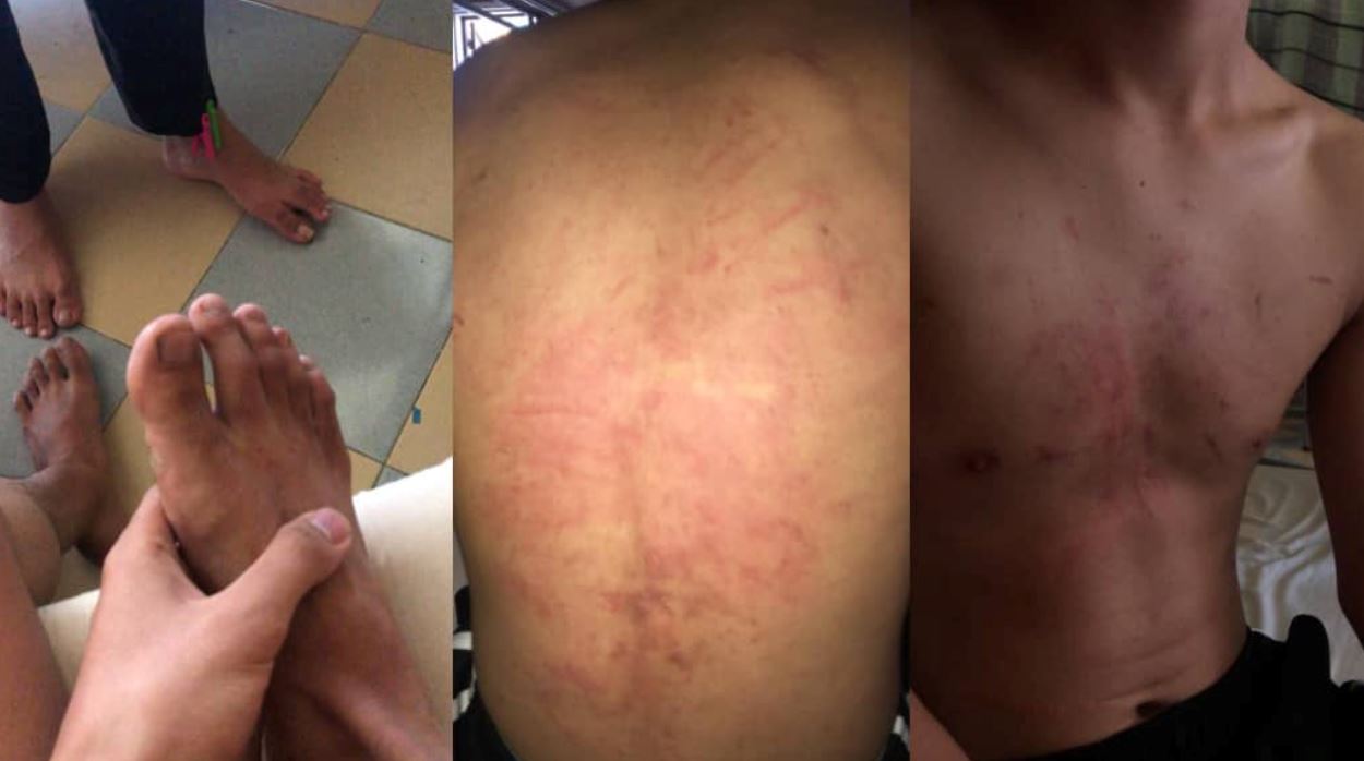 melaka student badly beaten for having a crush on the same girl