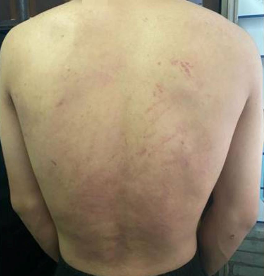 melaka student badly beaten for having a crush on the same girl