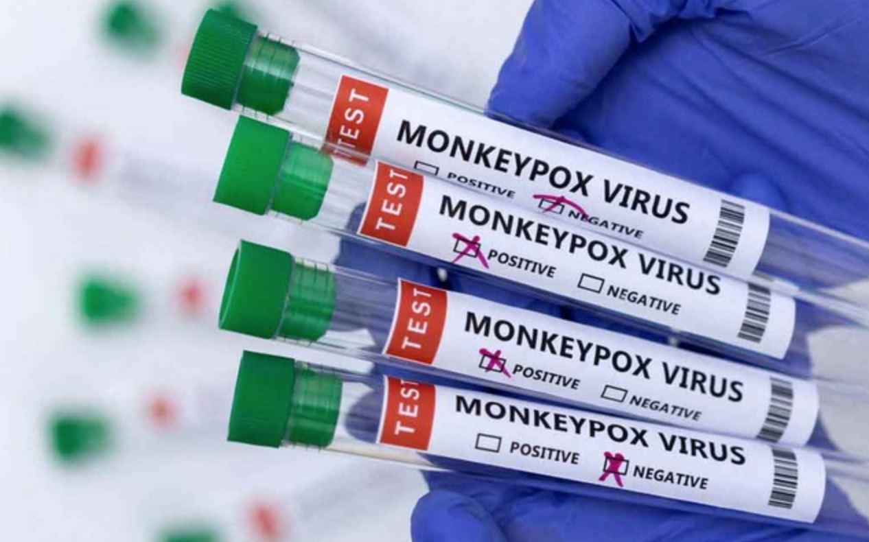 malaysian man confirmed as singapore’s first local monkeypox case