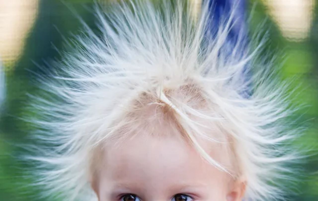 kes jarang berlaku, kanak-kanak ini alami sindrom rambut tidak bersikat