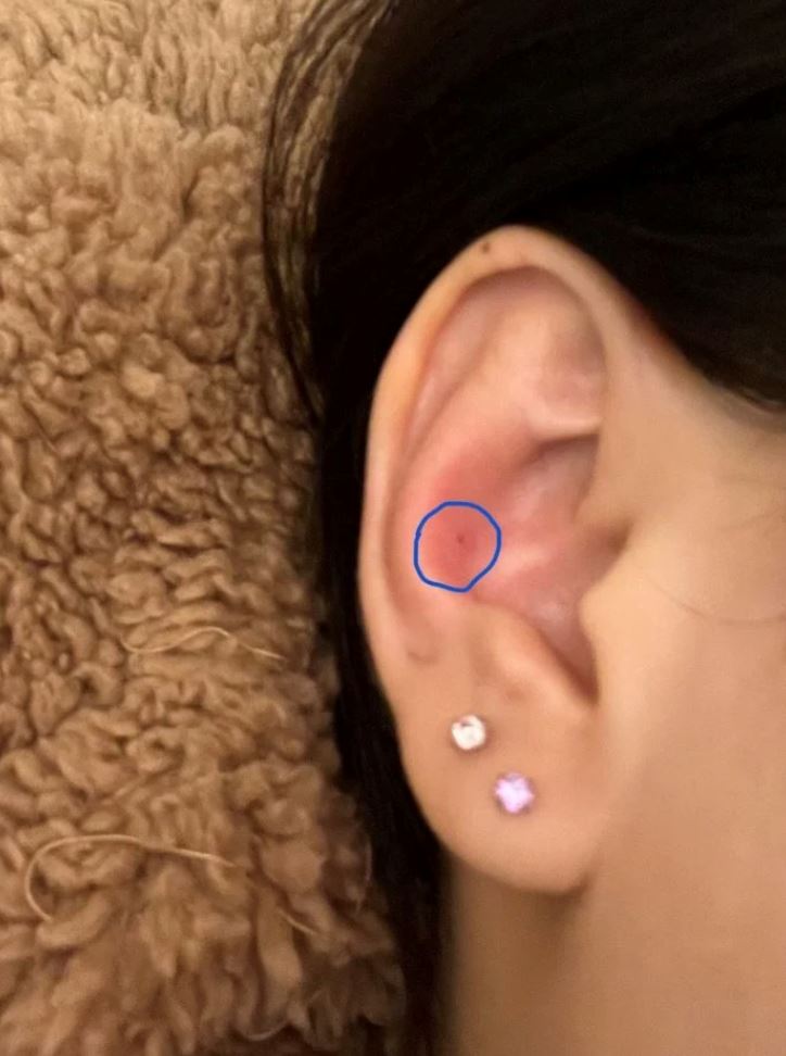 【趣闻】网友戴耳环差点休克死掉？网揭秘是这个原因！ 