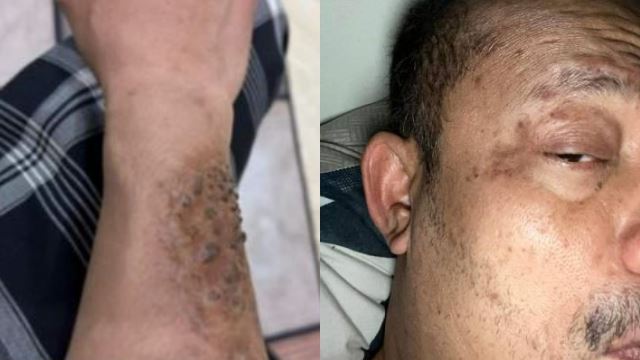 datuk ustaz kazim elias dedah ramai pihak termasuk kkm, pakar kaji sakit tampil bantu penyakit dideritainya