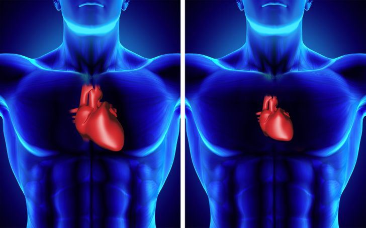 what happens to your body in space?