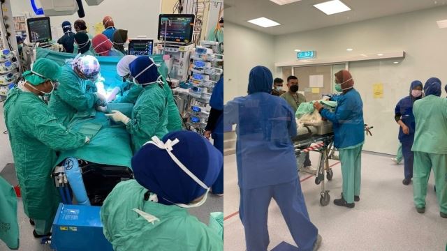 sejarah tercipta! kembar siam pramatang berjaya jalani pembedahan pisahkan bahagian hati