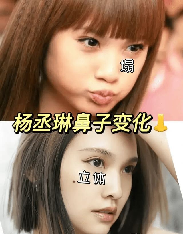 【台娱】网贴杨丞琳旧照质疑鼻子动刀太明显？竟钓出本尊霸气回应！ 