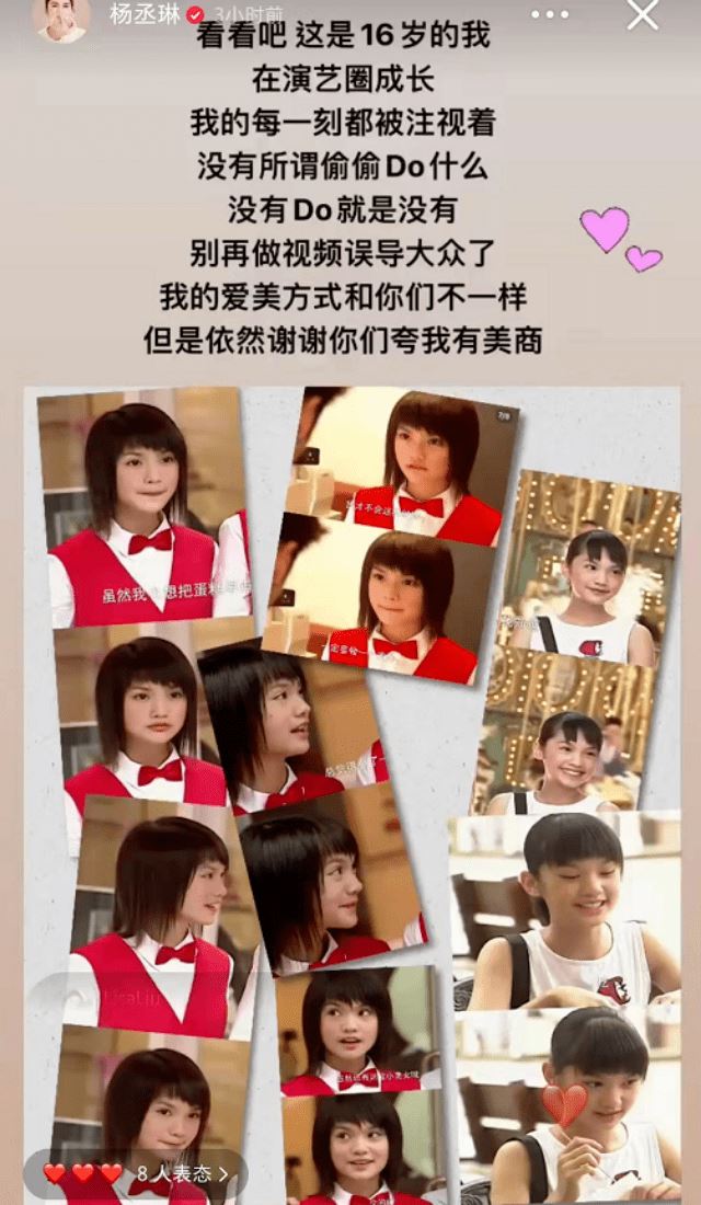 【台娱】网贴杨丞琳旧照质疑鼻子动刀太明显？竟钓出本尊霸气回应！ 