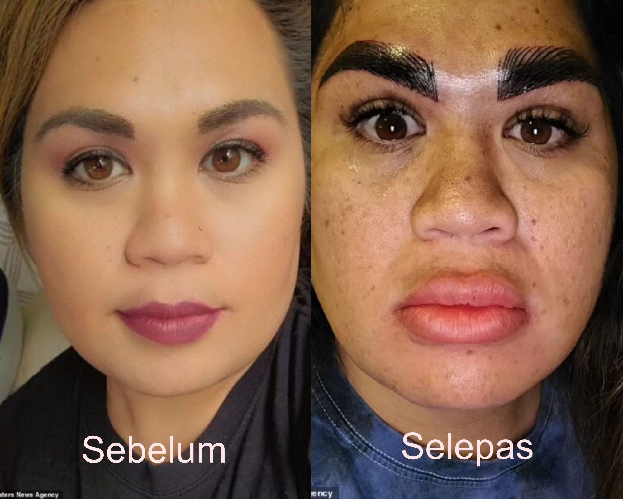 gara-gara kening macam shin chan, wanita ini terpaksa tahan malu