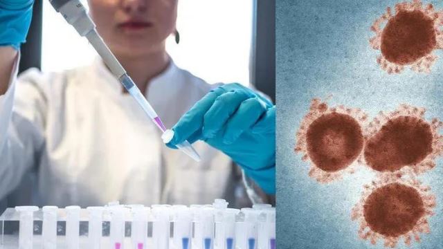 gelombang monkeypox, lebih banyak kes dijangka akan dikesan serata dunia