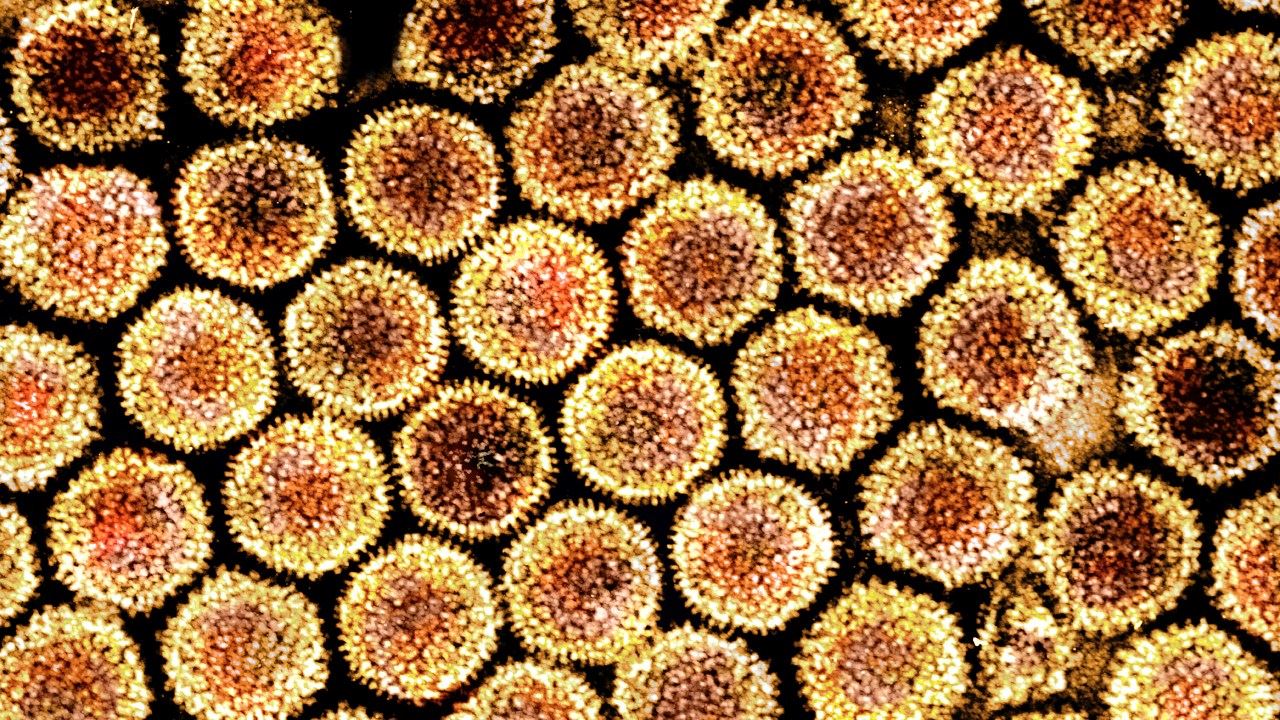 who kesan wabak hepatitis misteri yang makin merebak