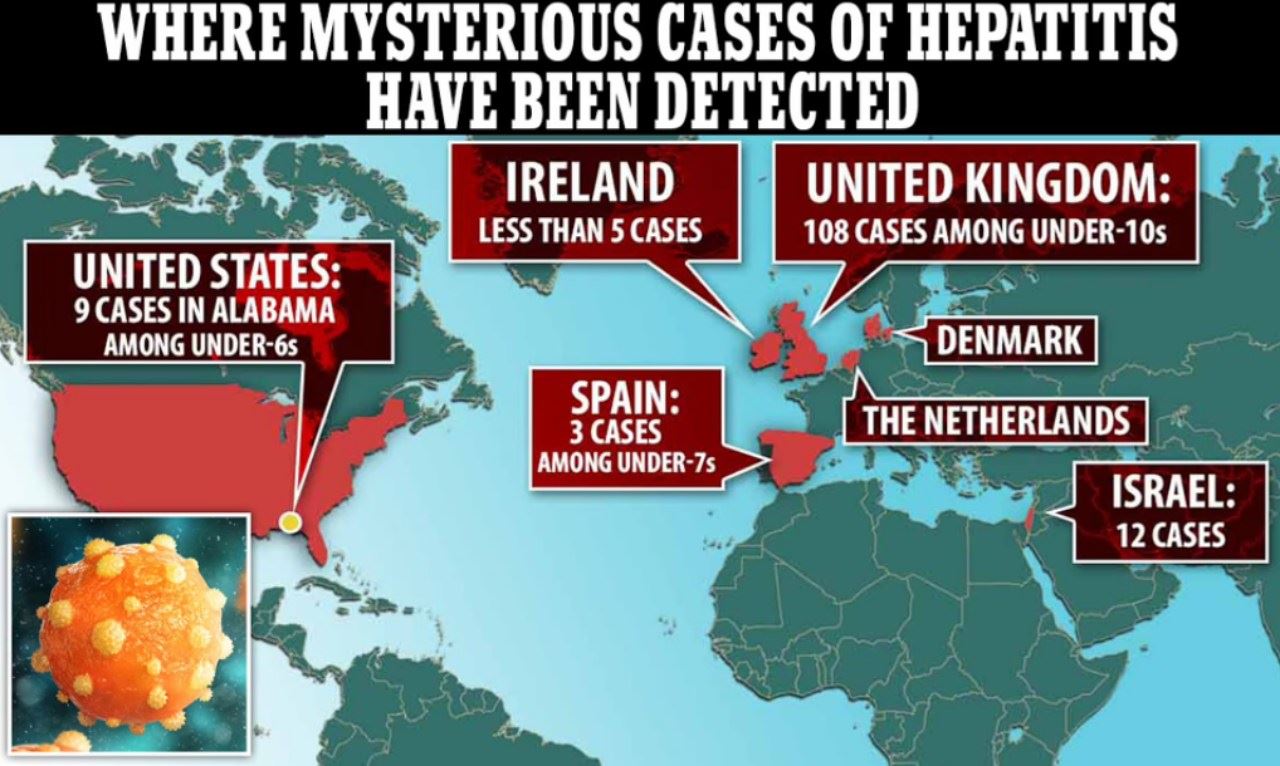 who kesan wabak hepatitis misteri yang makin merebak
