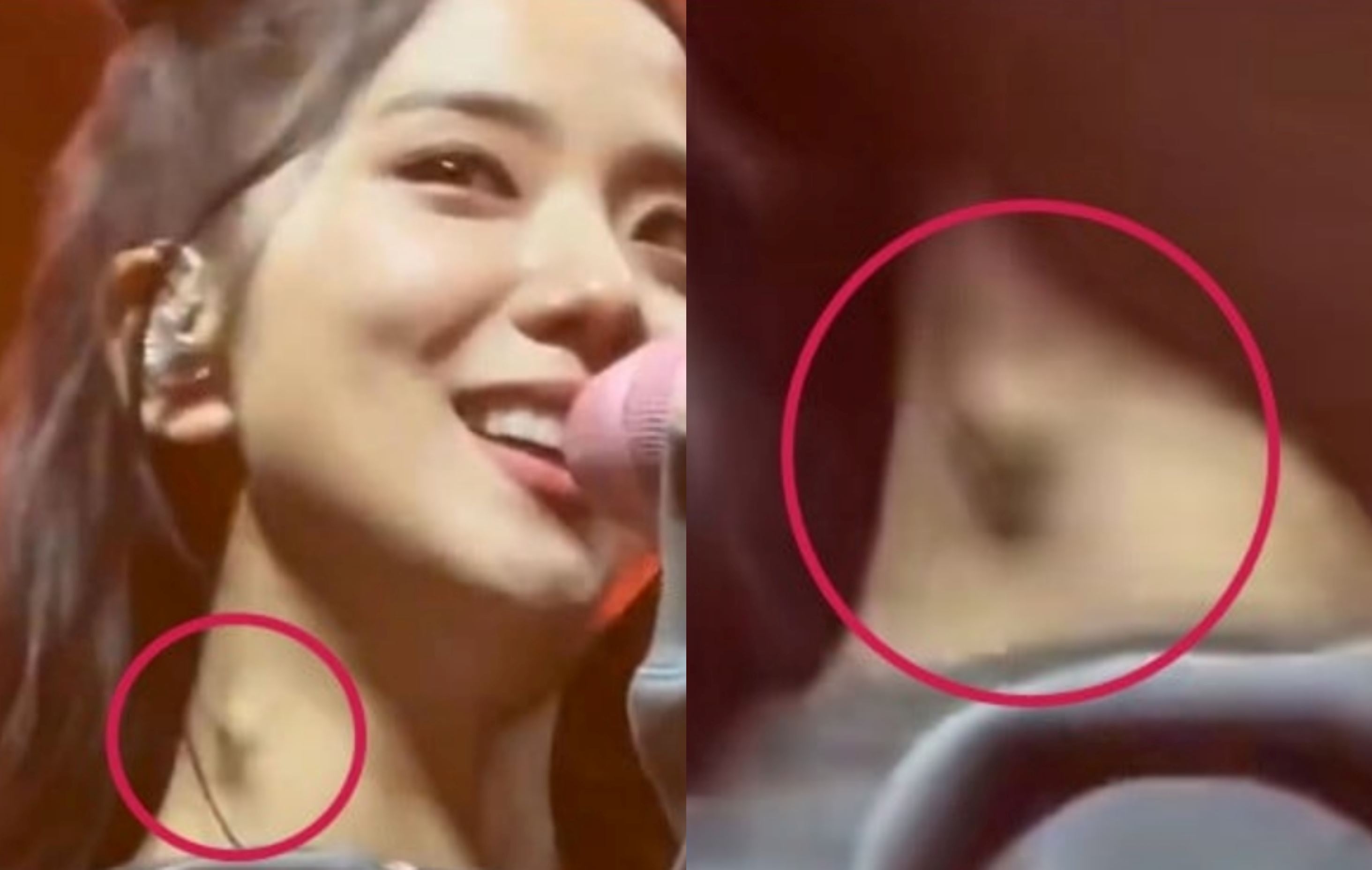 yg entertainment responds to concerns about blackpink member jisoo’s health after fans spotted a lump on her neck