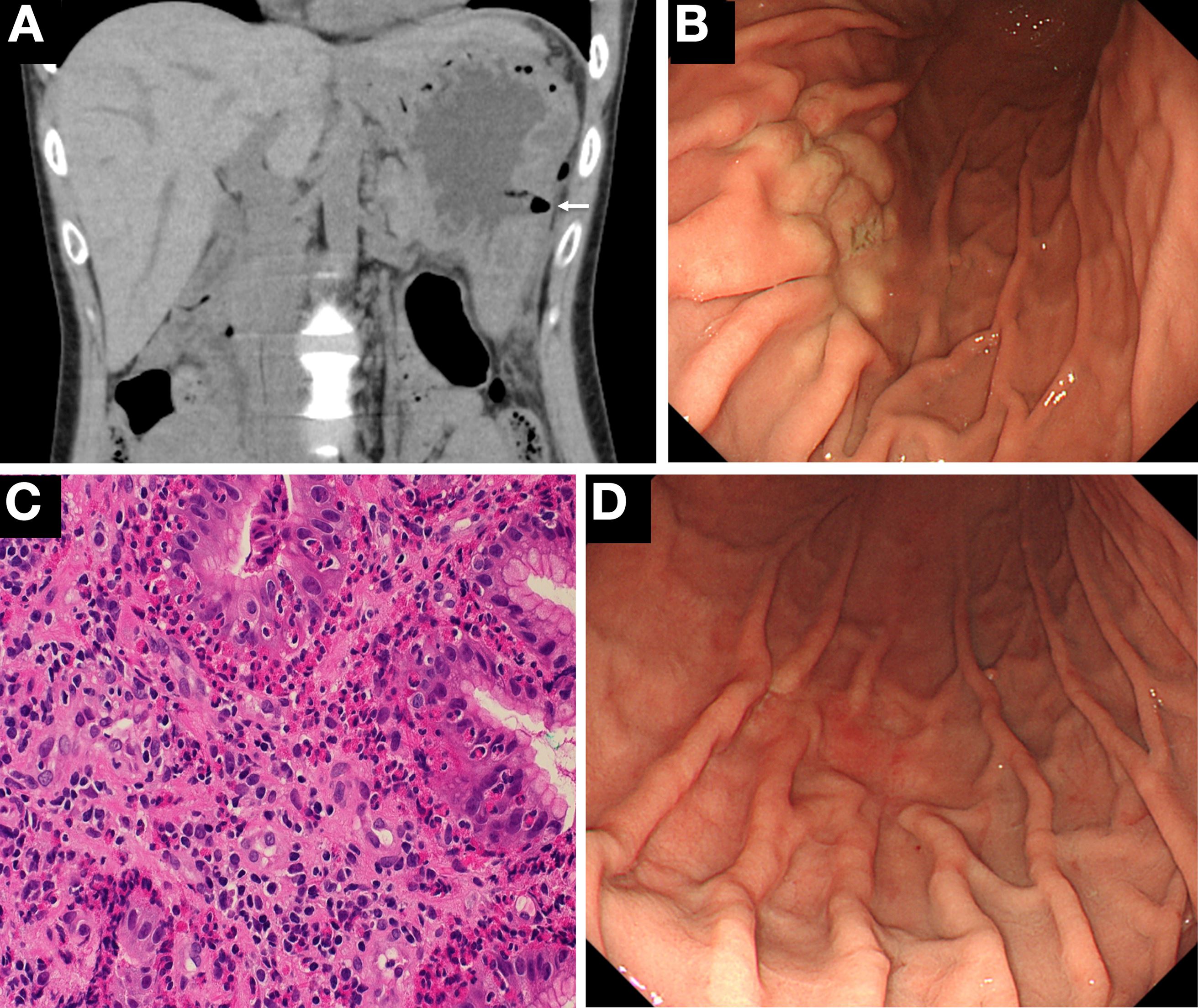 lelaki sakit tenat lepas makan ketam hidup yang sepit anaknya