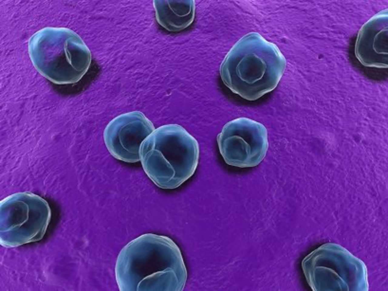 tabiat suka korek hidung boleh akibatkan nyanyuk – kajian