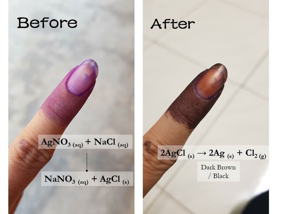 ini sebab kenapa jari ungu anda bertukar coklat lepas mengundi