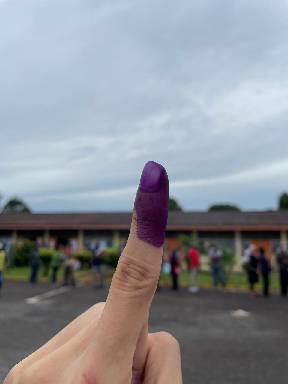 ini sebab kenapa jari ungu anda bertukar coklat lepas mengundi