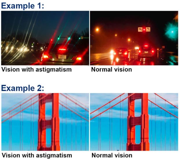 nampak cahaya macam ni waktu malam? anda mungkin alami masalah berikut