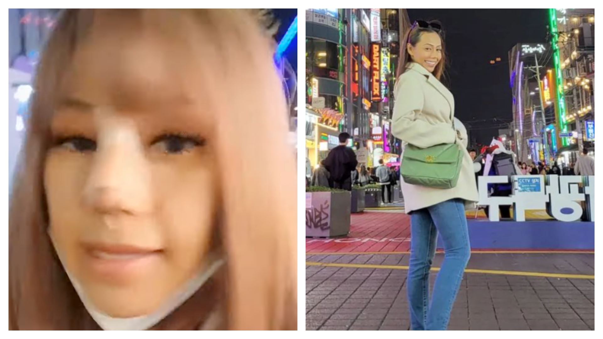 lana nodin akui jalani pembedahan plastik pada bahagian hidung