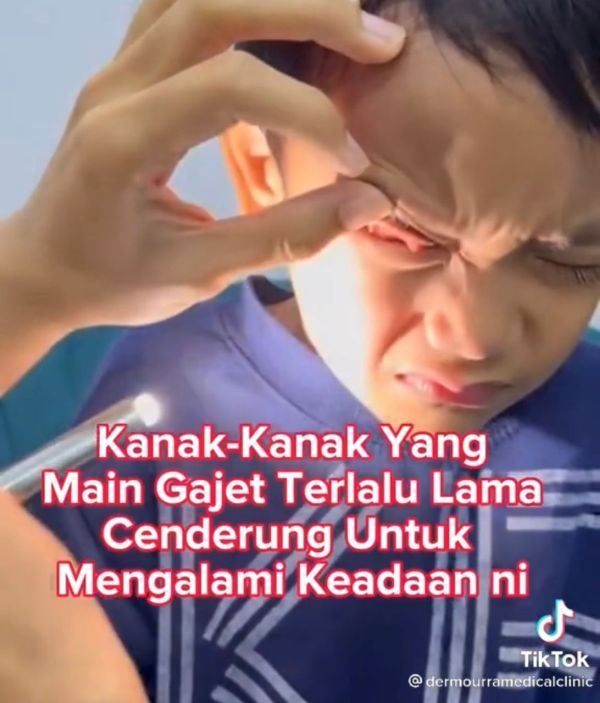 ibu terkejut lihat mata anaknya yang ketagih gajet