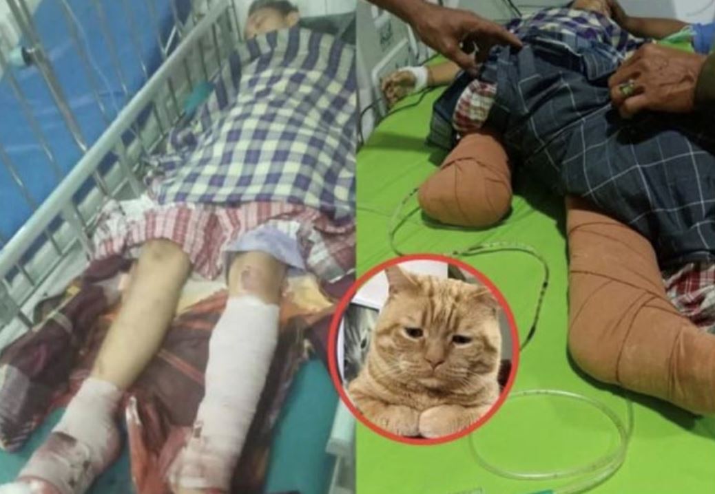 kanak-kanak hilang sebelah kaki digilis trak masa selamatkan kucing di jalan