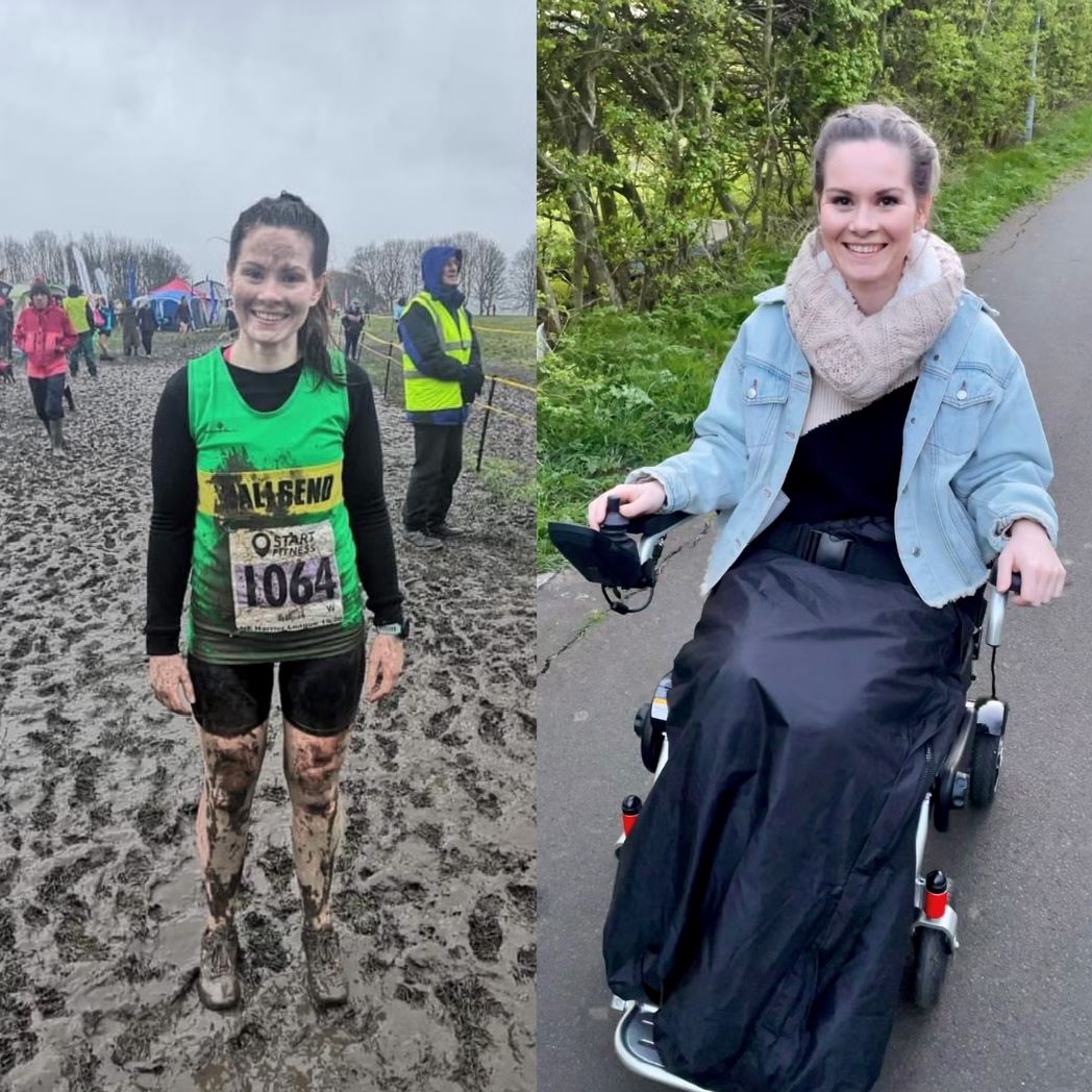 wanita derita tiga tahun tak boleh kencing gara-gara long covid