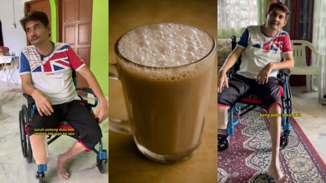 kerap minum teh tarik empat gelas sehari punca kaki dipotong