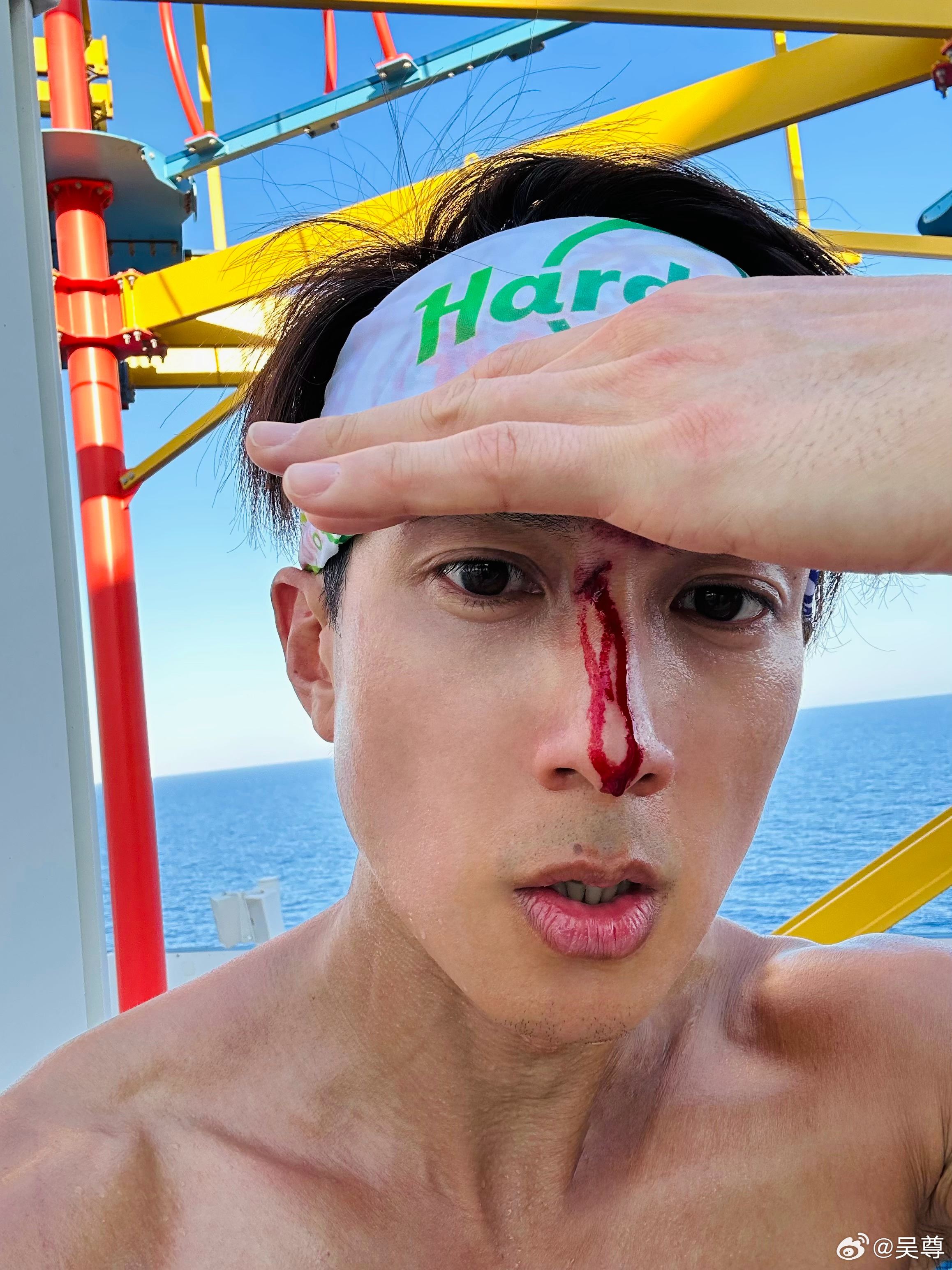 吴尊在打篮球的时候不慎受伤❗和儿女3对3打伤鼻子狂流血😱