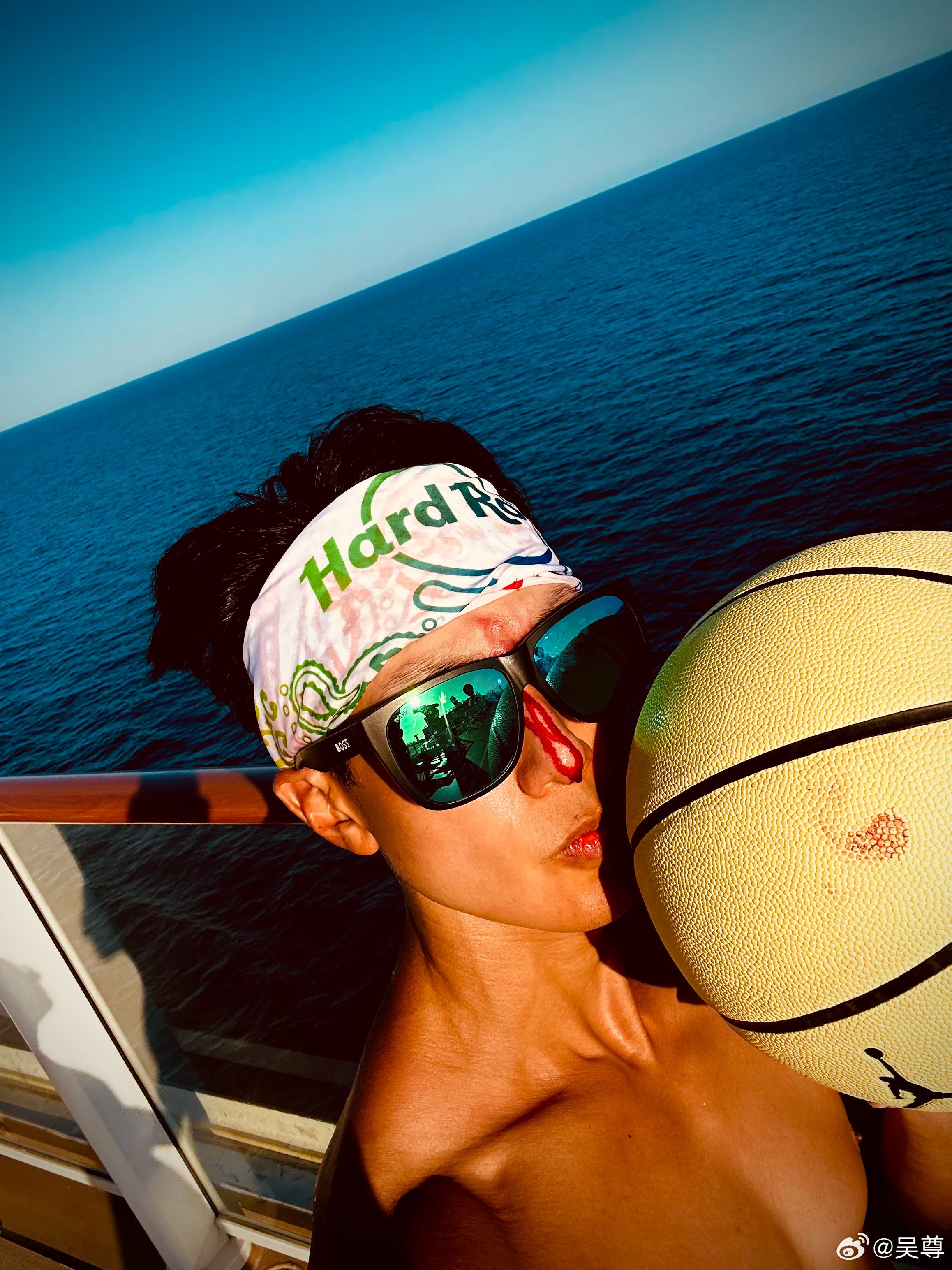 吴尊在打篮球的时候不慎受伤❗和儿女3对3打伤鼻子狂流血😱